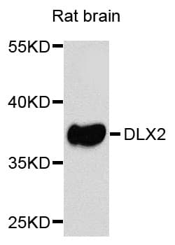 Polyclonal Rabbit anti-Human DLX2 Antibody (WB)