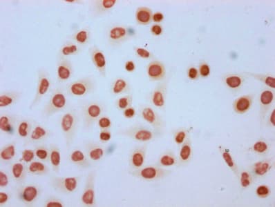 HIST1H2AI Antibody