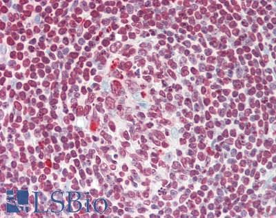 IHC-plus™ MAP2K7 / MEK7 Antibody (aa206-233)