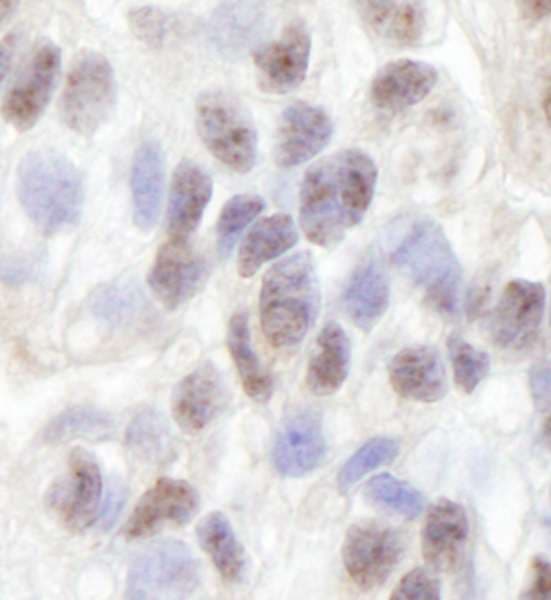 ZNF106 / ZFP106 Antibody (aa1833-1883)