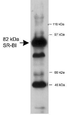 SCARB1 / SR-BI Antibody (Biotin)