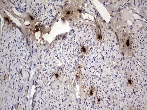 Monoclonal Mouse anti-Human SMPD1 / Acid Sphingomyelinase Antibody (clone OTI3H7, aa62-341, IHC, WB)