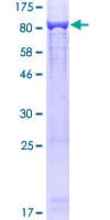 Human SARS / Serine-tRNA Ligase Protein (Recombinant GST)