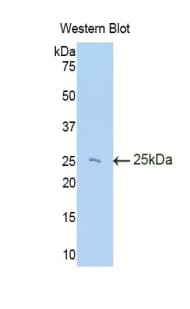 TIMP3 Antibody (aa27-209, Biotin)