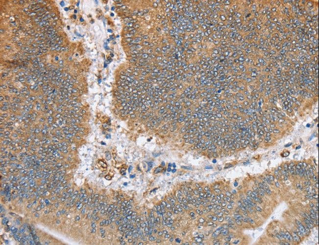 CANX / Calnexin Antibody