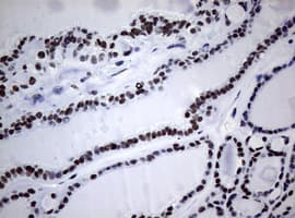 NBN / Nibrin Antibody (clone OTI6D10)