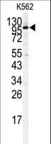 STAT2 Antibody (aa820-851)