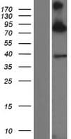 Human SIM1 Protein (Over-Expression Lysate Myc-DDK (Flag))