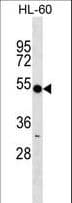 RNF14 / ARA54 Antibody (aa336-364)
