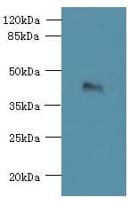 Polyclonal Rabbit anti-Human TMEM59L Antibody (IHC, WB)