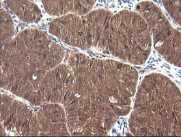 CTAG1B / NY-ESO-1 Antibody (clone OTI4C12)