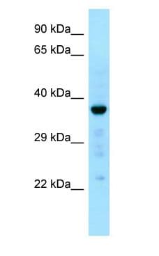 CAPZA1 / CAPZ Alpha 1 Antibody (aa70-119)
