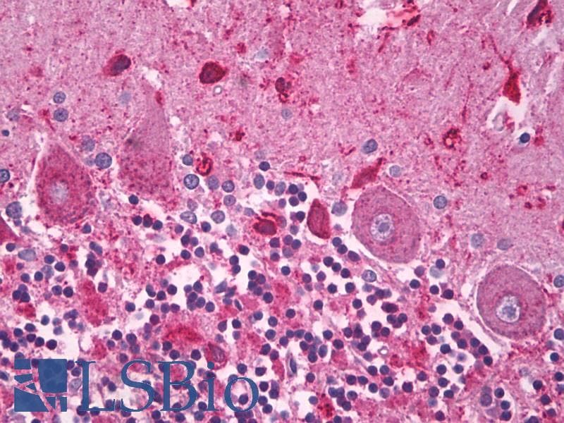IHC-plus™ SLC25A6 / ANT3 Antibody (aa121-170)