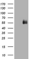 Monoclonal Mouse anti-Human CD2 Antibody (clone OTI3E11, IHC, WB)