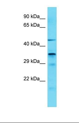 IST1 Antibody (aa193-242)