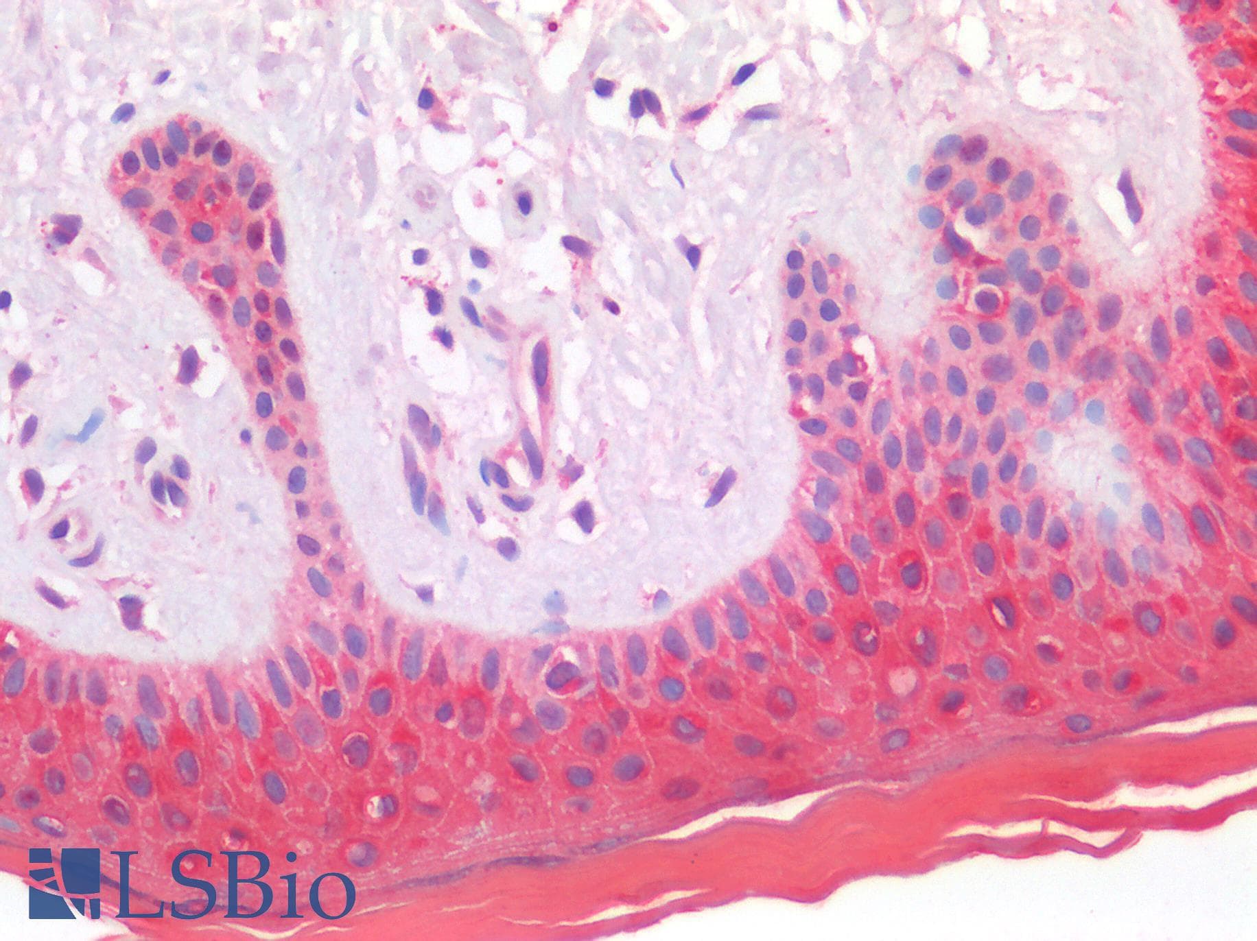 IHC-plus™ Polyclonal Goat anti-Human S100A8 / MRP8 Antibody (aa49-62, IHC, WB)