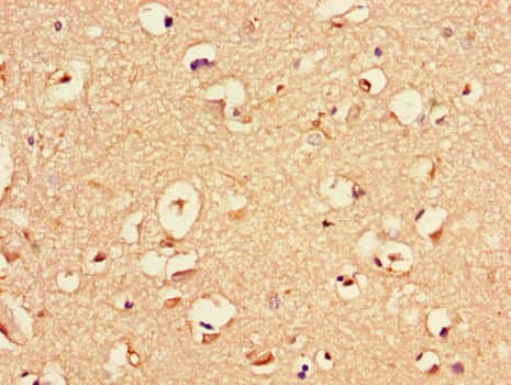 NGF Antibody