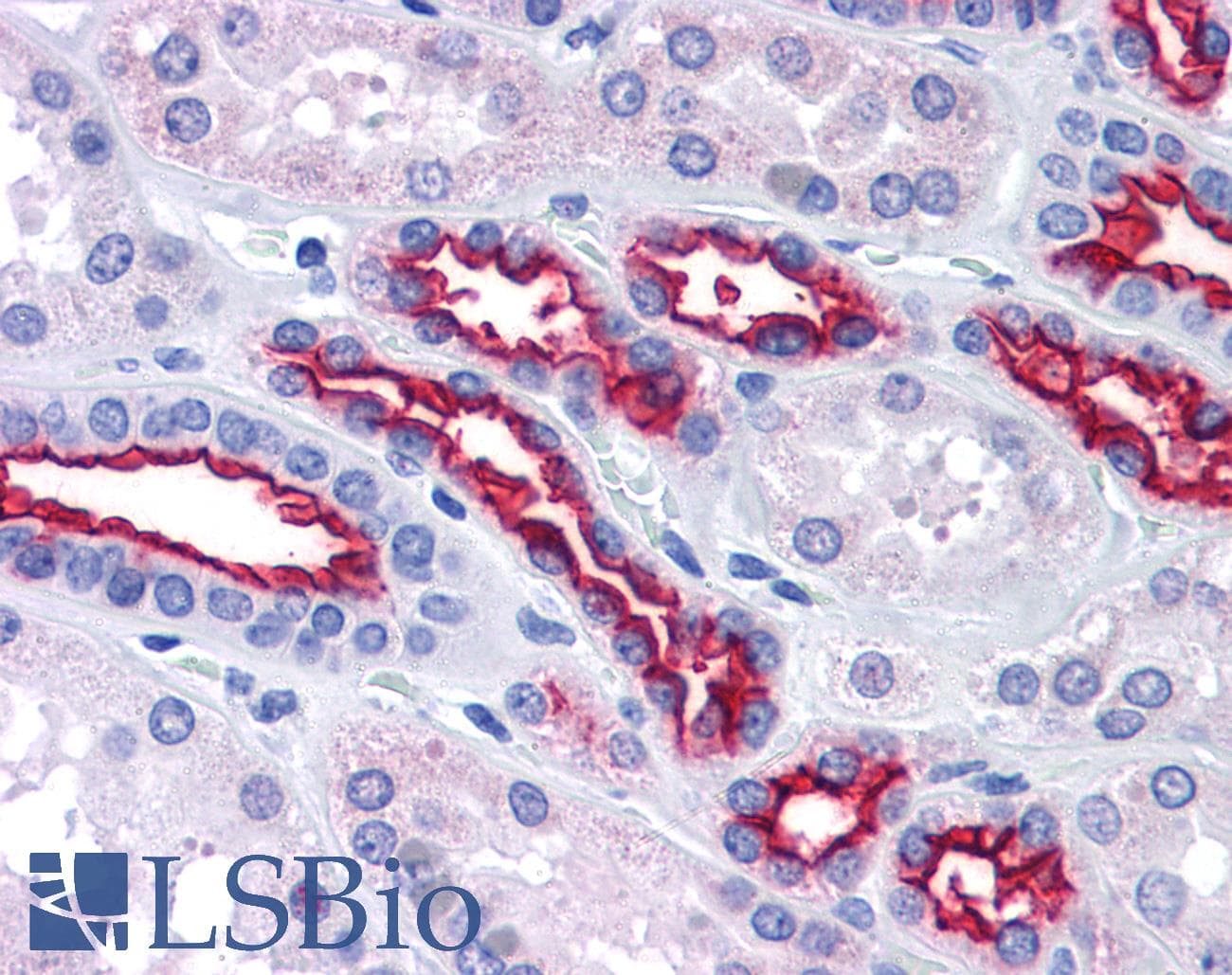IHC-plus™ EMA / MUC1 Antibody