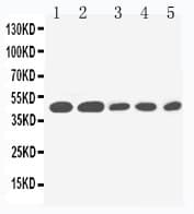 IL2RG / CD132 Antibody (aa88-102)