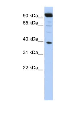 Polyclonal Rabbit anti-Human HOXB2 Antibody (aa71-120, WB)