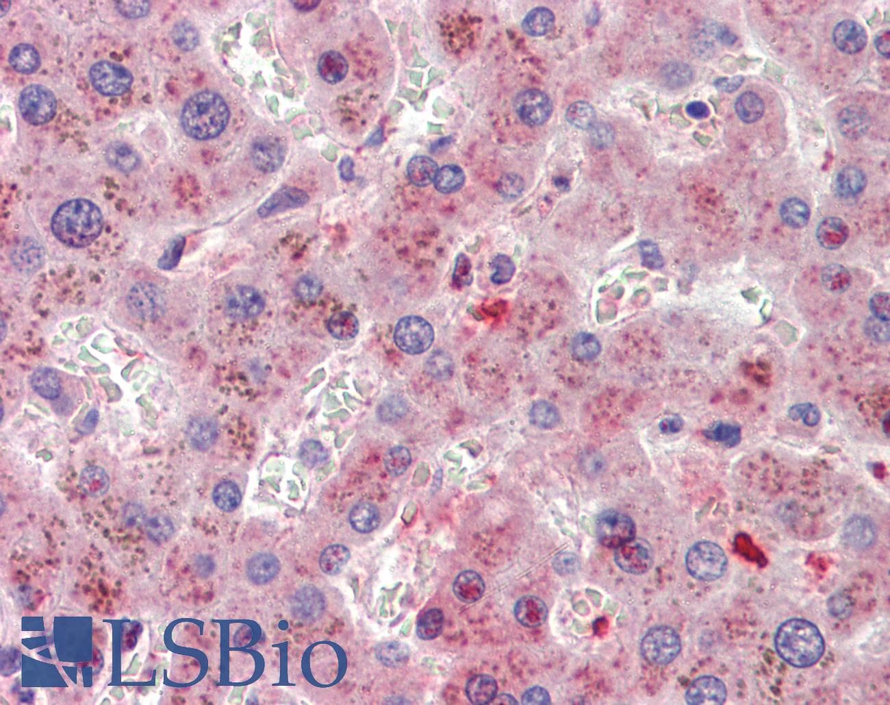 IHC-plus™ 5-Alpha Reductase / SRD5A1 Antibody (aa173-184)