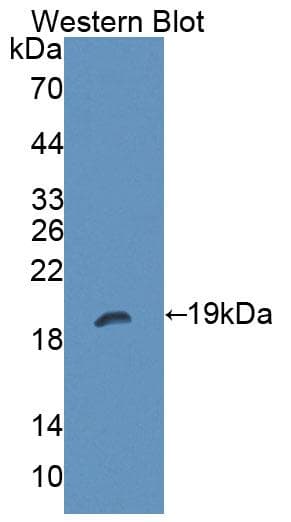 PTPRZ1 / Phosphacan Antibody