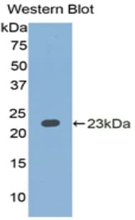IL1A / IL-1 Alpha Antibody (aa90-268, PE)