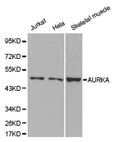 AURKA / Aurora-A Antibody