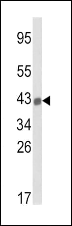 HLA-B Antibody (aa62-90)