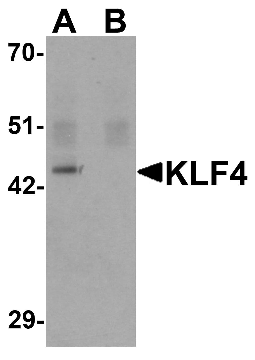 KLF4 Antibody (clone 4G6E11)
