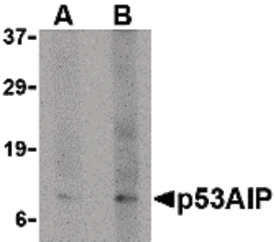 IHC-plus™ TP53AIP1 / p53 AIP1 Antibody