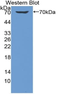 KIR2DL1 / CD158a Antibody (aa22-348)