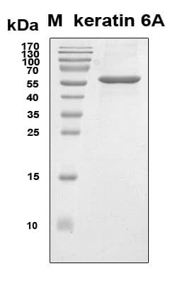 Human KRT6A / CK6A / Cytokeratin 6A Protein (Recombinant 6His, N-terminus)