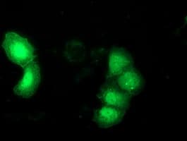 DNAJB1 / Hsp40 Antibody (clone OTI1B12)