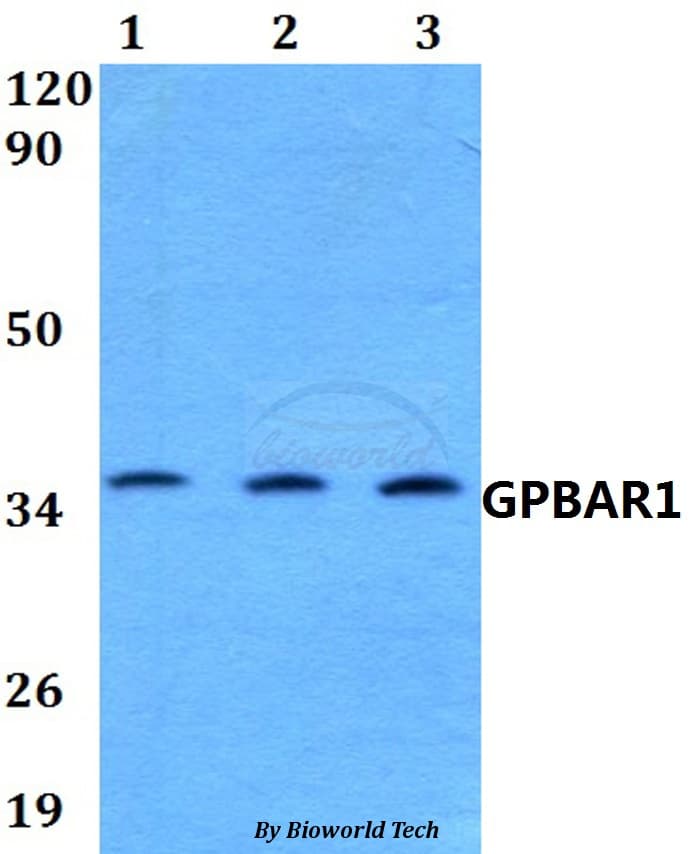 Polyclonal Rabbit anti-Human GPBAR1 / TGR5 Antibody (WB)