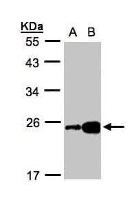 IHC-plus™ I-BABP / FABP6 Antibody (aa1-142)