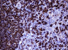 CD20 Antibody (clone OTI3C4)