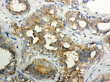 Calpain Antibody (aa396-555)