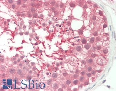 IHC-plus™ Polyclonal Sheep anti-Human ACP1 / Acid Phosphatase Antibody (IHC, WB)