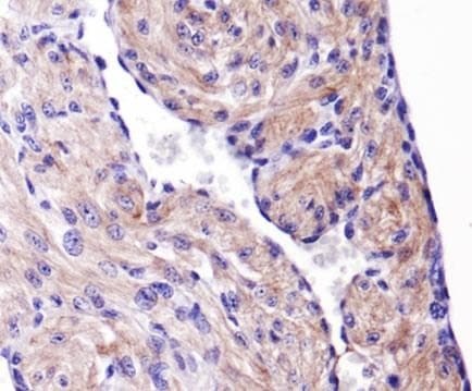 HSPB1 / HSP27 Antibody