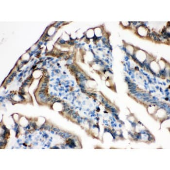 Polyclonal Rabbit anti-Human PLEC / Plectin Antibody (aa2644-2671, IHC, WB)