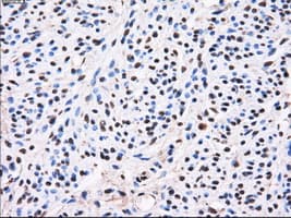 AKR1A1 Antibody (clone OTI2E7)