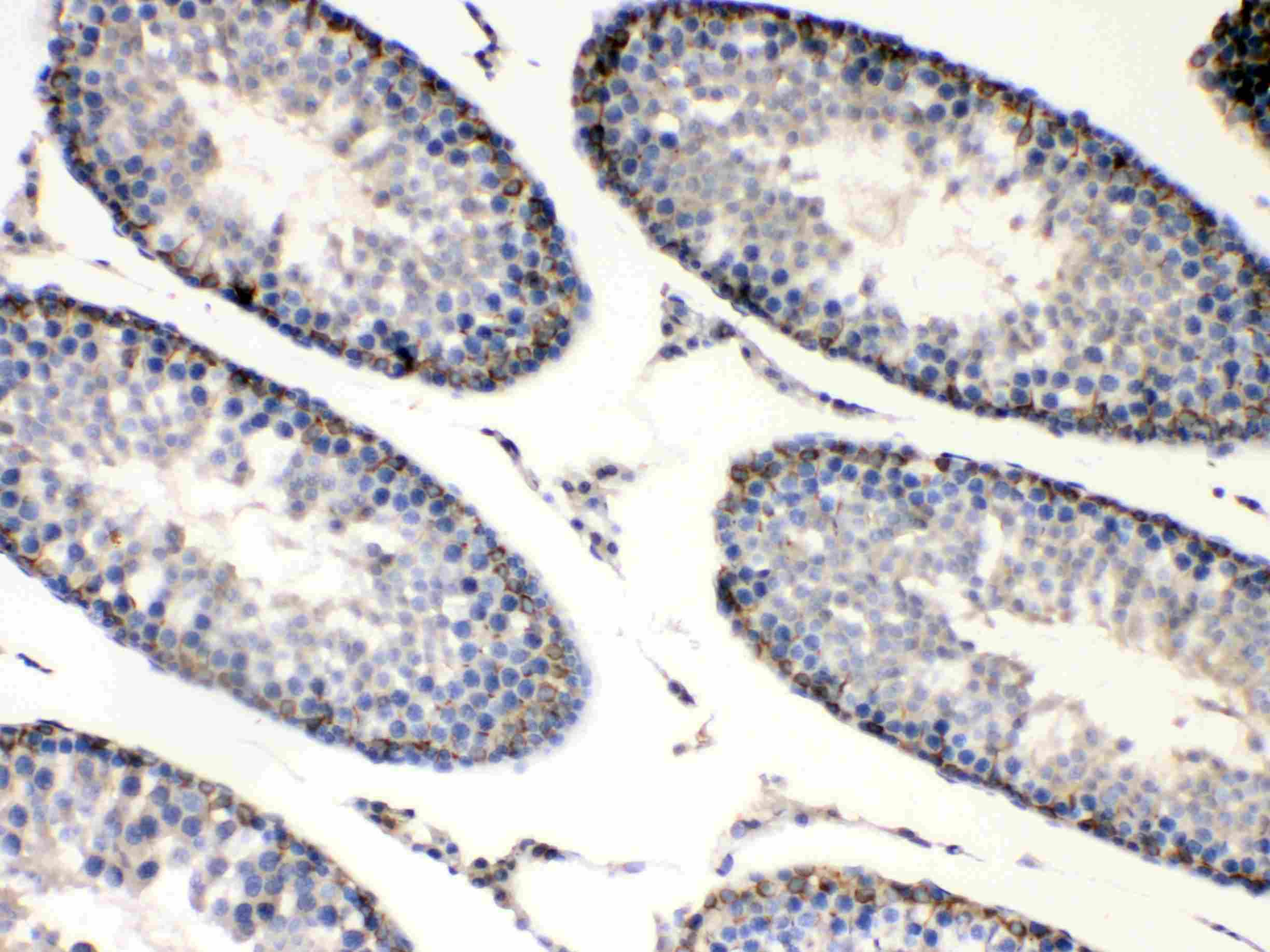 BAG1 / BAG-1 Antibody