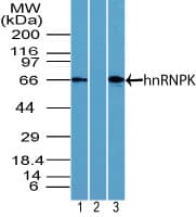 PathPlus™ HNRNPK / hnRNP K Antibody (aa200-250)