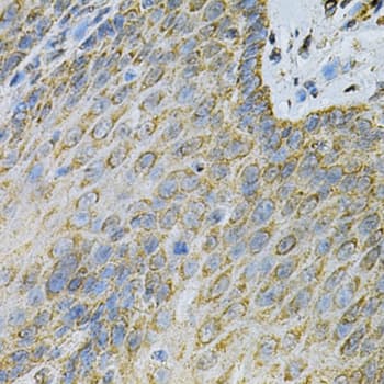 AK1 / Adenylate Kinase 1 Antibody