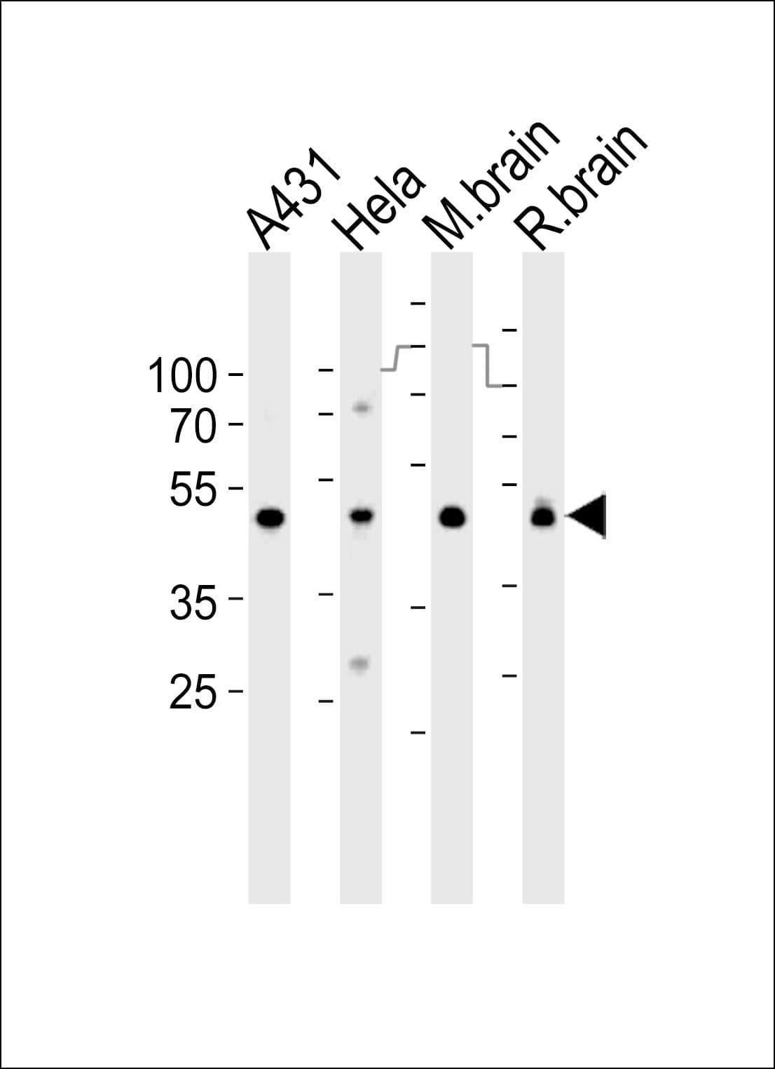 NDUFS2 Antibody (aa286-315)