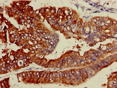 ACS5 / ACSL5 Antibody