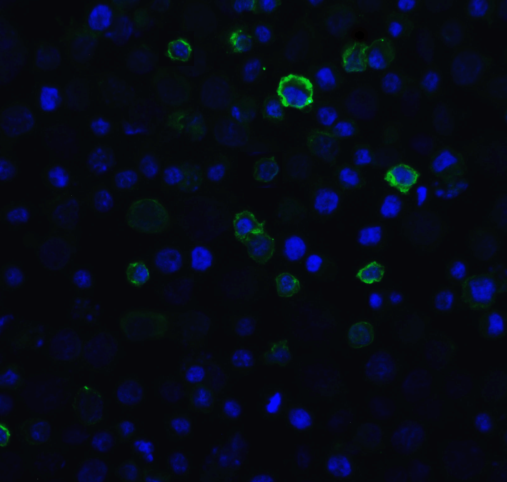 PathPlus™ Monoclonal Mouse anti-Human PDCD1 / CD279 / PD-1 Antibody (clone 5D3, IHC, IF)