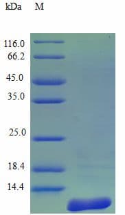 Human CCL27 Protein (Recombinant)