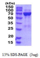 Human PGM2 Protein (Recombinant His)